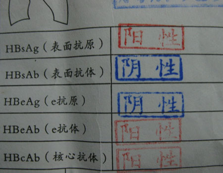 乙肝病毒携带者