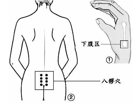 女性妇科病 中医常按穴可防妇科病