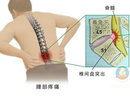 男女频繁有这个动作腰早晚废了