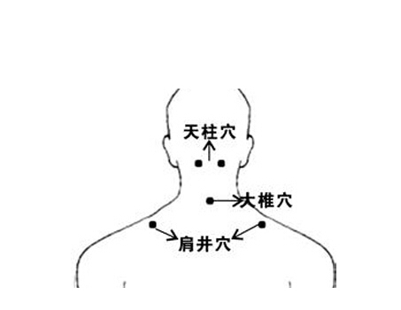 脊椎病保健操 根据不同人群制定保健操