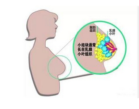 女性乳腺增生的检查方法？