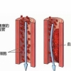 <b>预防脑血栓方法 谨记血栓疾病6个红色信号</b>