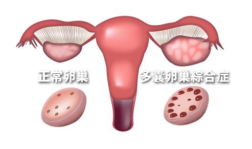 女生掉发的普遍情况 你中枪了吗