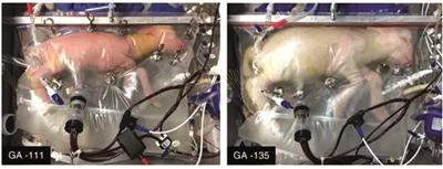 “人造子宫”让超早产羔羊存活四周 且发育正常