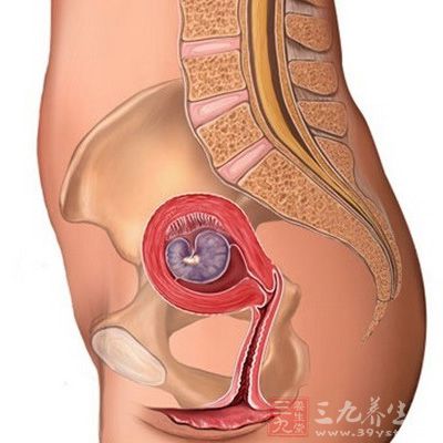 除了少做以上的行为外，还要如何保护我们的子宫呢