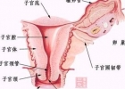 子宫移位的原因 这些行为千万不能有