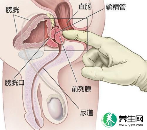 男人患前列腺增生：原因危害有哪些？